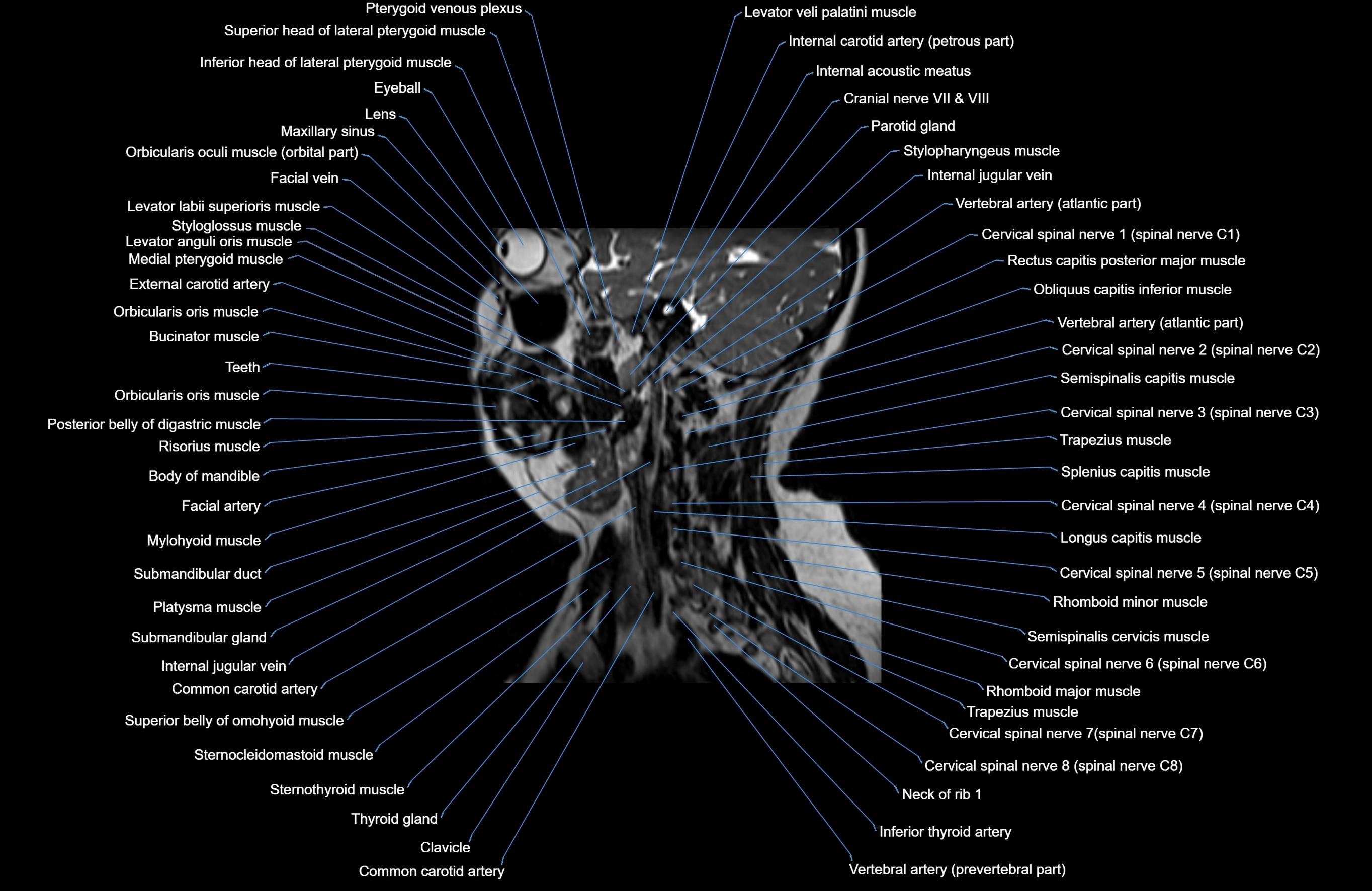 Neck MRI sagittal cross sectional anatomy 3D 1mm 3T radiology  image-img-00001-00019.webp